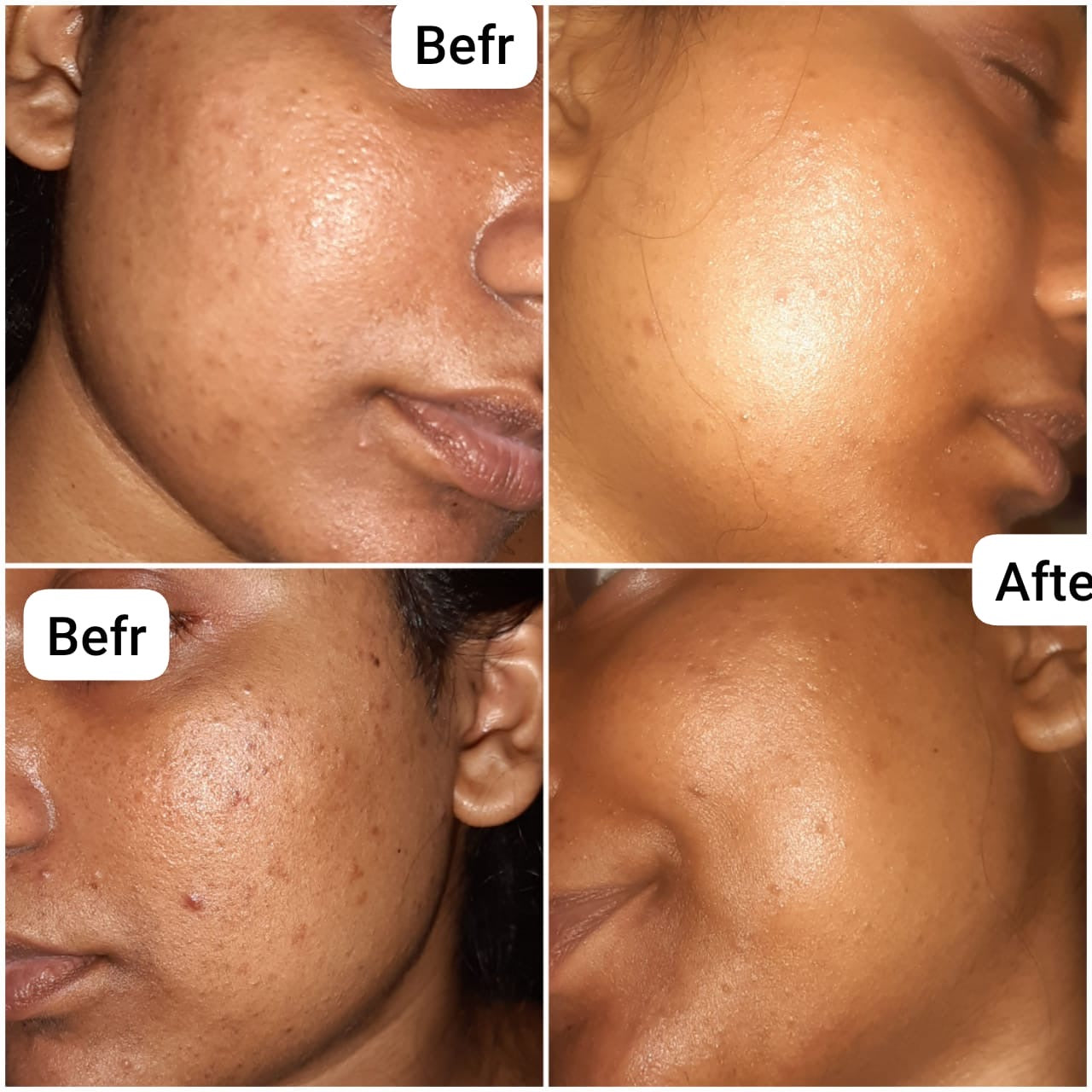 RenewBurst Face Wash