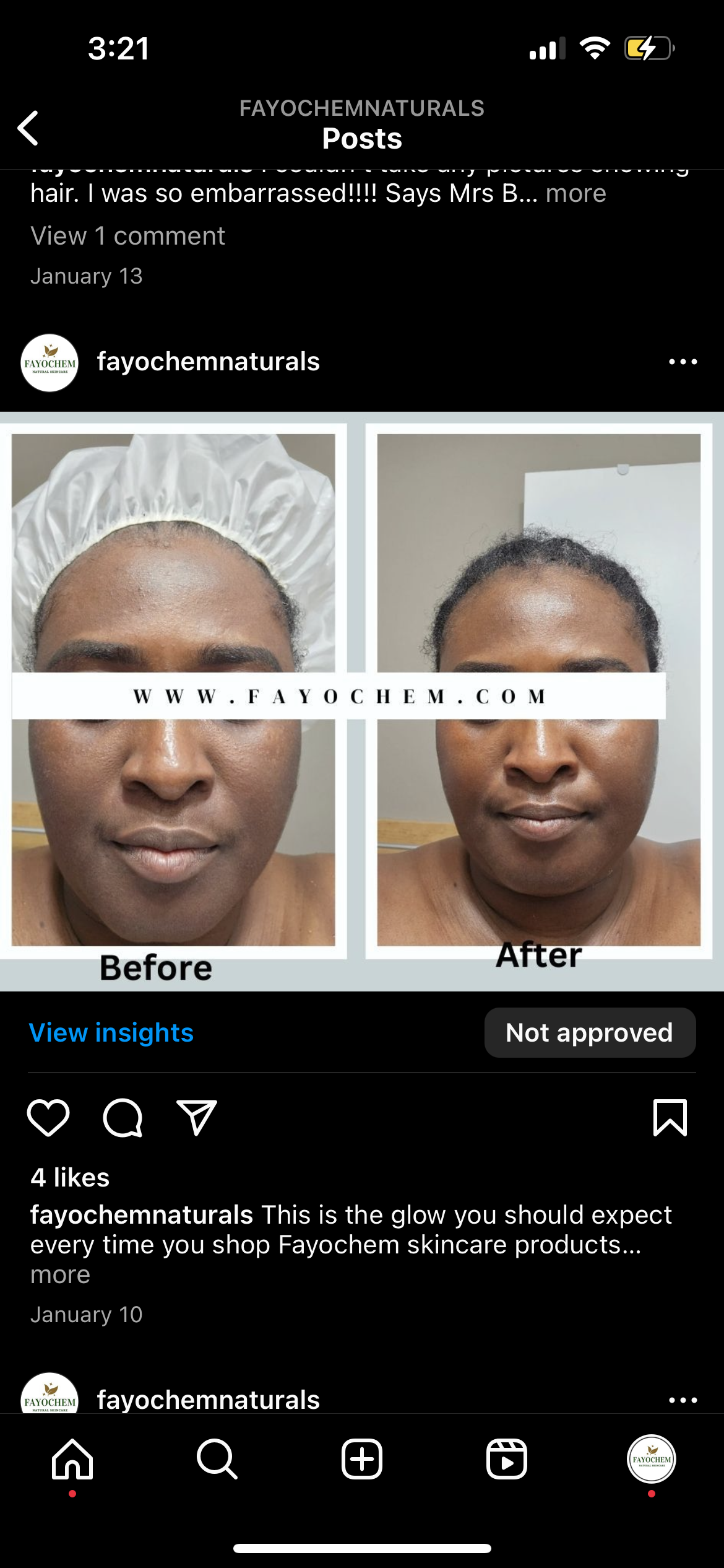 ToneCorrect Essentials Set