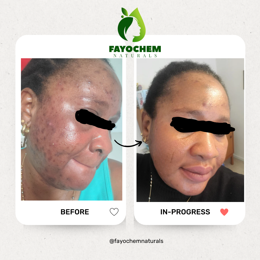 LUMINA FACE SERUM