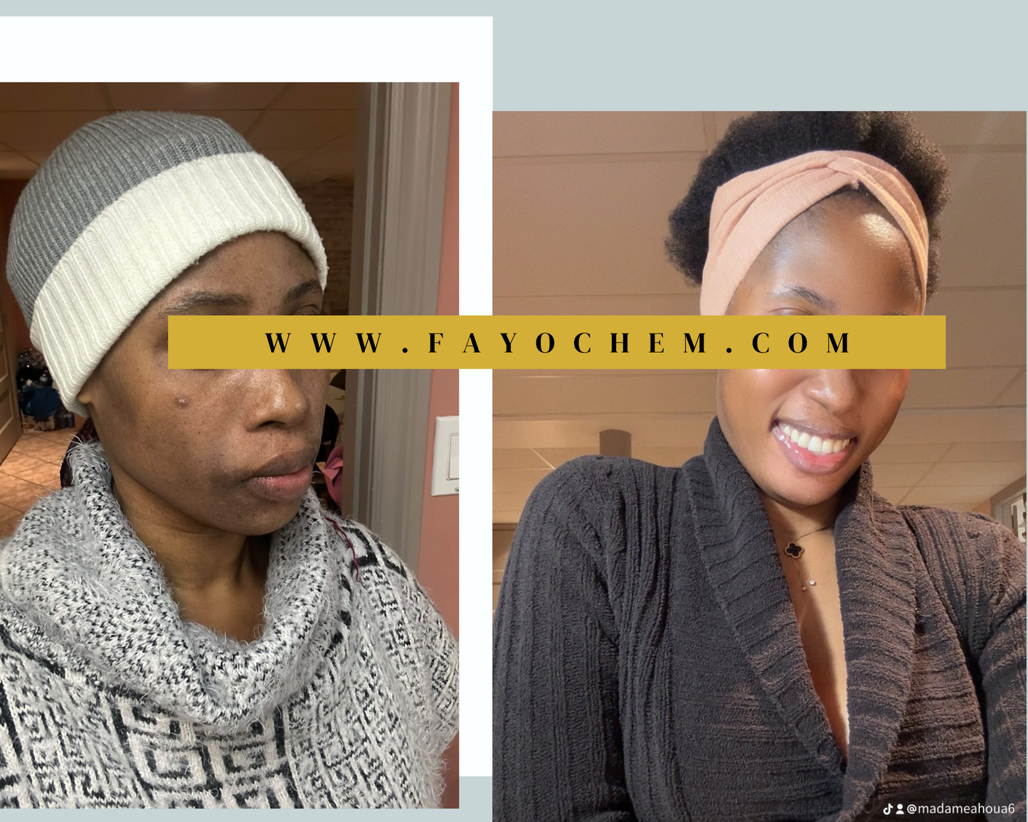 ToneCorrect Essentials Set