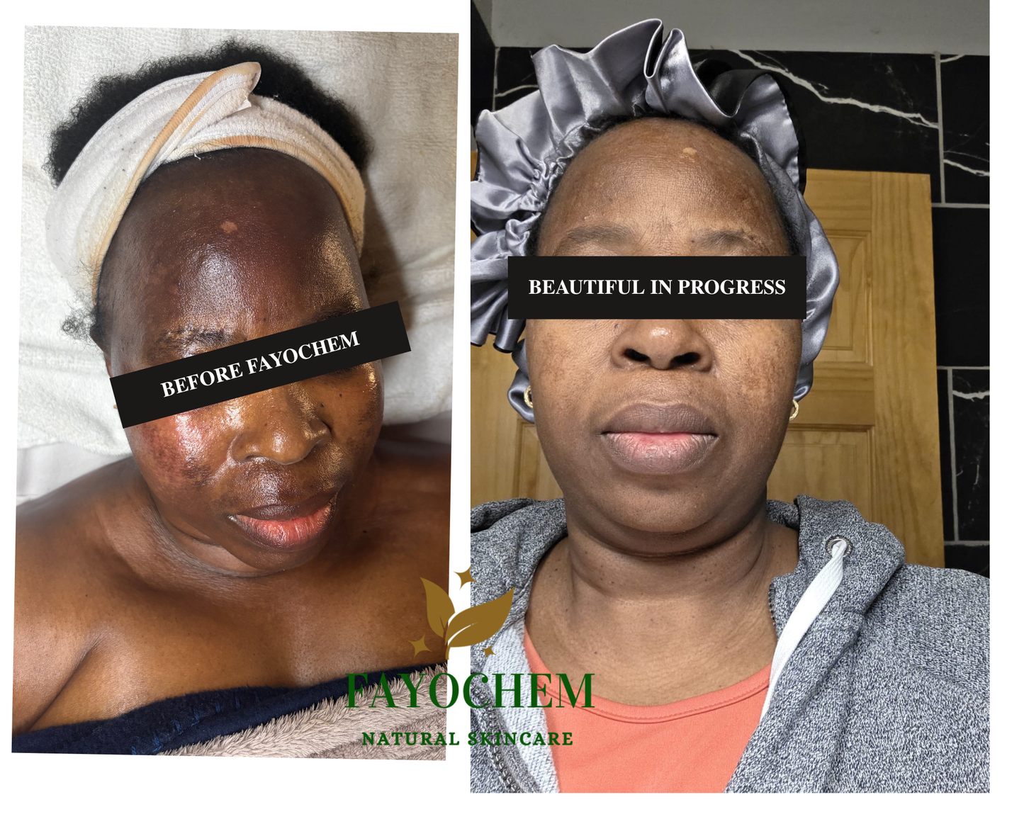 Advanced Custom Facial — Toronto Pop-Up