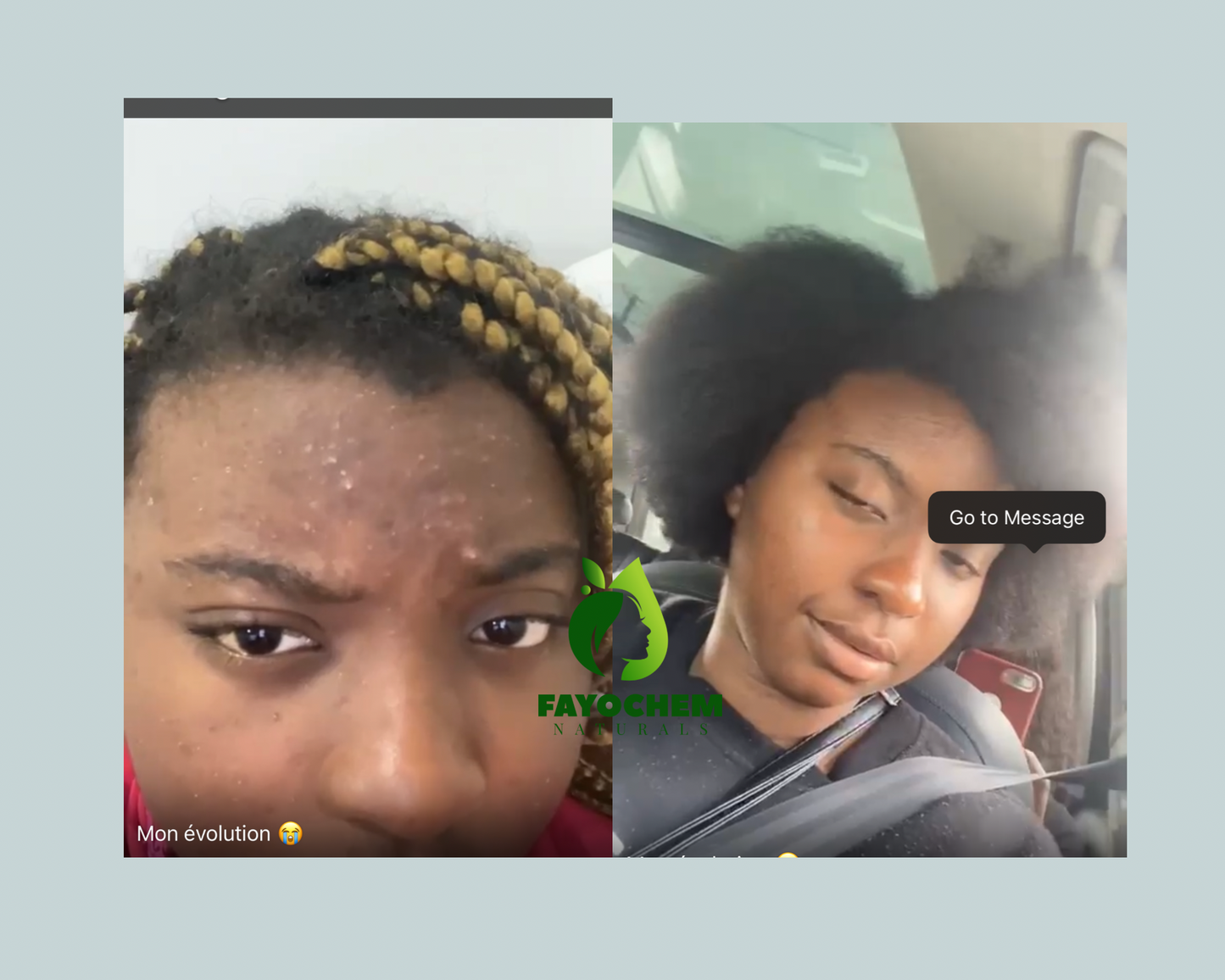 Crème hydratante pour le visage SkinFix
