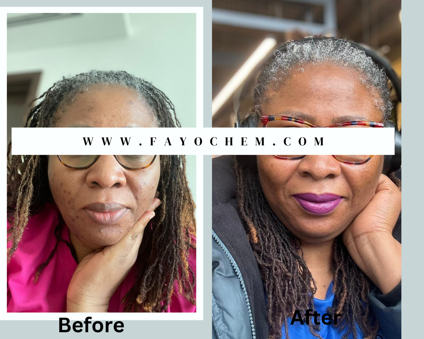 Restoration Glow Set