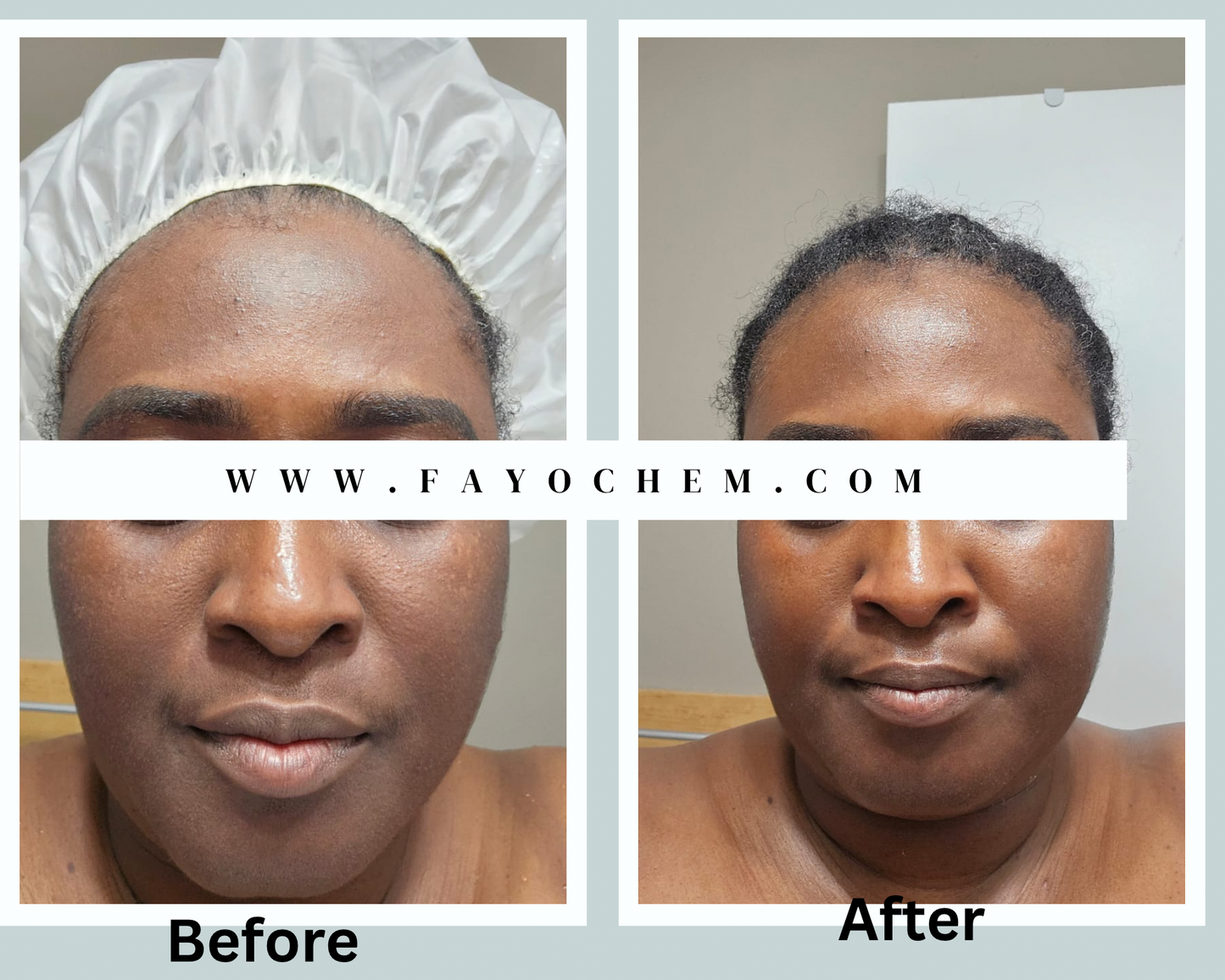 Restoration Glow Set