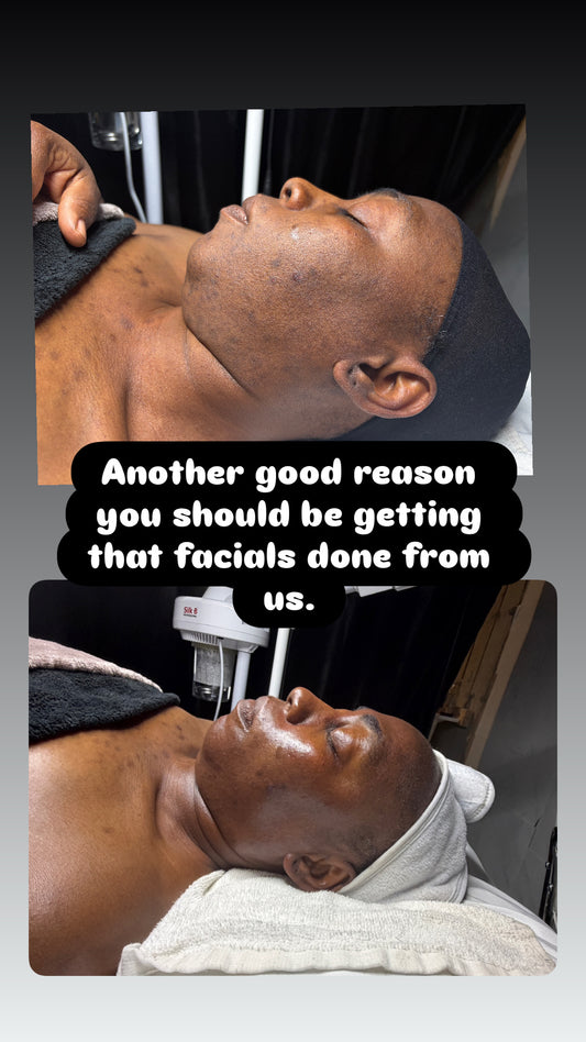 Advanced Custom Facial — Toronto Pop-Up