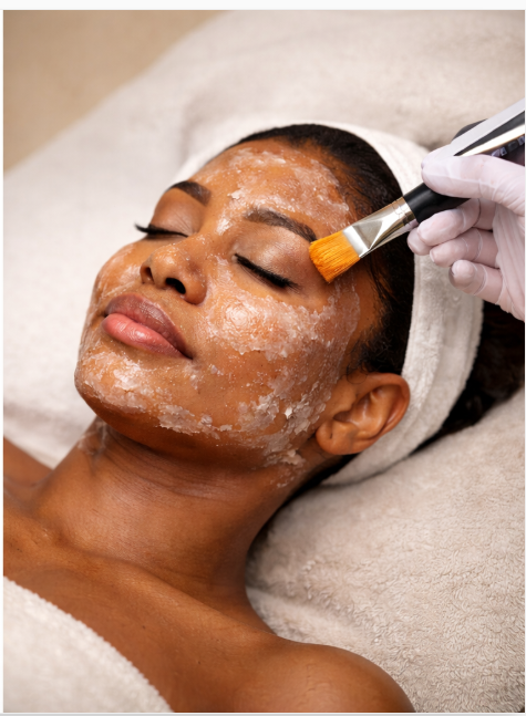Perfect Derma  peel